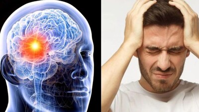 Revolutionary Blood Test Detects Brain Tumors with 90% Accuracy