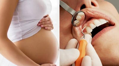 Planning Pregnancy? Visit Dentist First for Healthier Mother & Baby