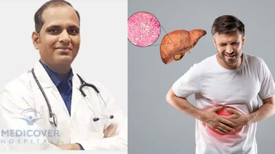 फैटी लिवर: शुरुआती पहचान और प्राकृतिक रूप से कम करने के उपाय