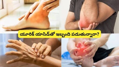 Uric Acid Spiking? Beyond Diet: Dehydration, Meds, Genes Are Key Factors