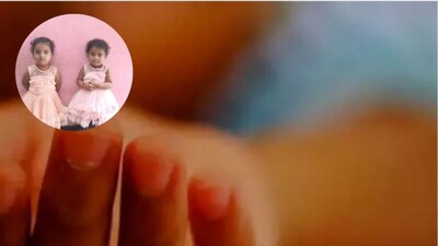 చనిపోయిన కవలలు