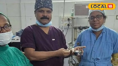 పదిరూపాయలు కాయిన్ మింగాడు పదిరోజులైనా బయటకు రాకపోవడంతో ఏం జరిగిందంటే పదిరూపాయలు కాయిన్ మింగాడు పదిరోజులైనా బయటకు రాకపోవడంతో ఏం జరిగిందంటే