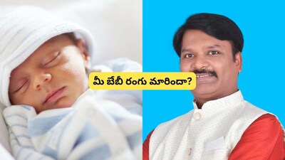 Baby Skin Color: Why Newborns Change Hue After Birth? Experts Explain