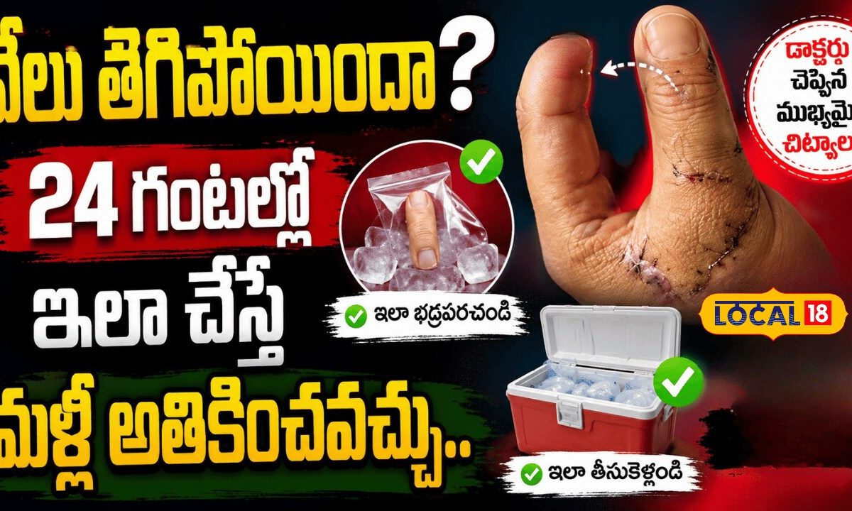 How to Save a Severed Finger | వేలు తెగిపోయిందా? 24 గంటల్లో ఇలా చేస్తే మళ్లీ అతికించవచ్చు