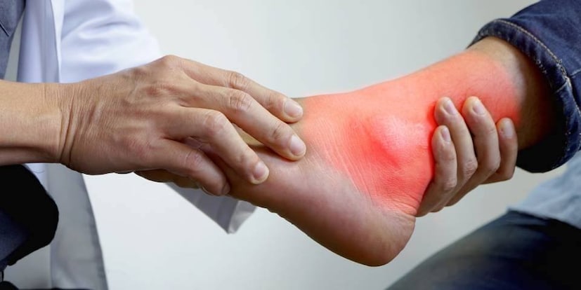 Causes and treatment of uric acid Causes and treatment of uric acid