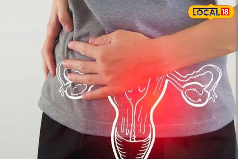 বিশেষজ্ঞসকলৰ মতে, PCOS নিয়ন্ত্ৰণত খাদ্যাভ্যাসে অত্যন্ত গুৰুত্বপূৰ্ণ ভূমিকা পালন কৰে। দৈনিক খাদ্যত আঁহযুক্ত শাক-পাচলি, ডাইল, ওটছ, ৰঙা চাউল বা আটাৰ ৰুটি, কণী, মাছ, মুৰ্গীৰ মাংস, টেঙা দৈ আৰু কম চেনিযুক্ত ফল অন্তৰ্ভুক্ত কৰাৰ পৰামৰ্শ দিয়া হয়। এই খাদ্যসমূহে ৰক্তত শৰ্কৰাৰ মাত্ৰা স্থিৰ কৰি ৰখাৰ লগতে ইনচুলিনৰ কাৰ্যক্ষমতা বজাই ৰখাত সহায় কৰে, যি PCOS নিয়ন্ত্ৰণত বিশেষভাৱে গুৰুত্বপূৰ্ণ। বিশেষজ্ঞসকলৰ মতে, PCOS নিয়ন্ত্ৰণত খাদ্যাভ্যাসে অত্যন্ত গুৰুত্বপূৰ্ণ ভূমিকা পালন কৰে। দৈনিক খাদ্যত আঁহযুক্ত শাক-পাচলি, ডাইল, ওটছ, ৰঙা চাউল বা আটাৰ ৰুটি, কণী, মাছ, মুৰ্গীৰ মাংস, টেঙা দৈ আৰু কম চেনিযুক্ত ফল অন্তৰ্ভুক্ত কৰাৰ পৰামৰ্শ দিয়া হয়। এই খাদ্যসমূহে ৰক্তত শৰ্কৰাৰ মাত্ৰা স্থিৰ কৰি ৰখাৰ লগতে ইনচুলিনৰ কাৰ্যক্ষমতা বজাই ৰখাত সহায় কৰে, যি PCOS নিয়ন্ত্ৰণত বিশেষভাৱে গুৰুত্বপূৰ্ণ।