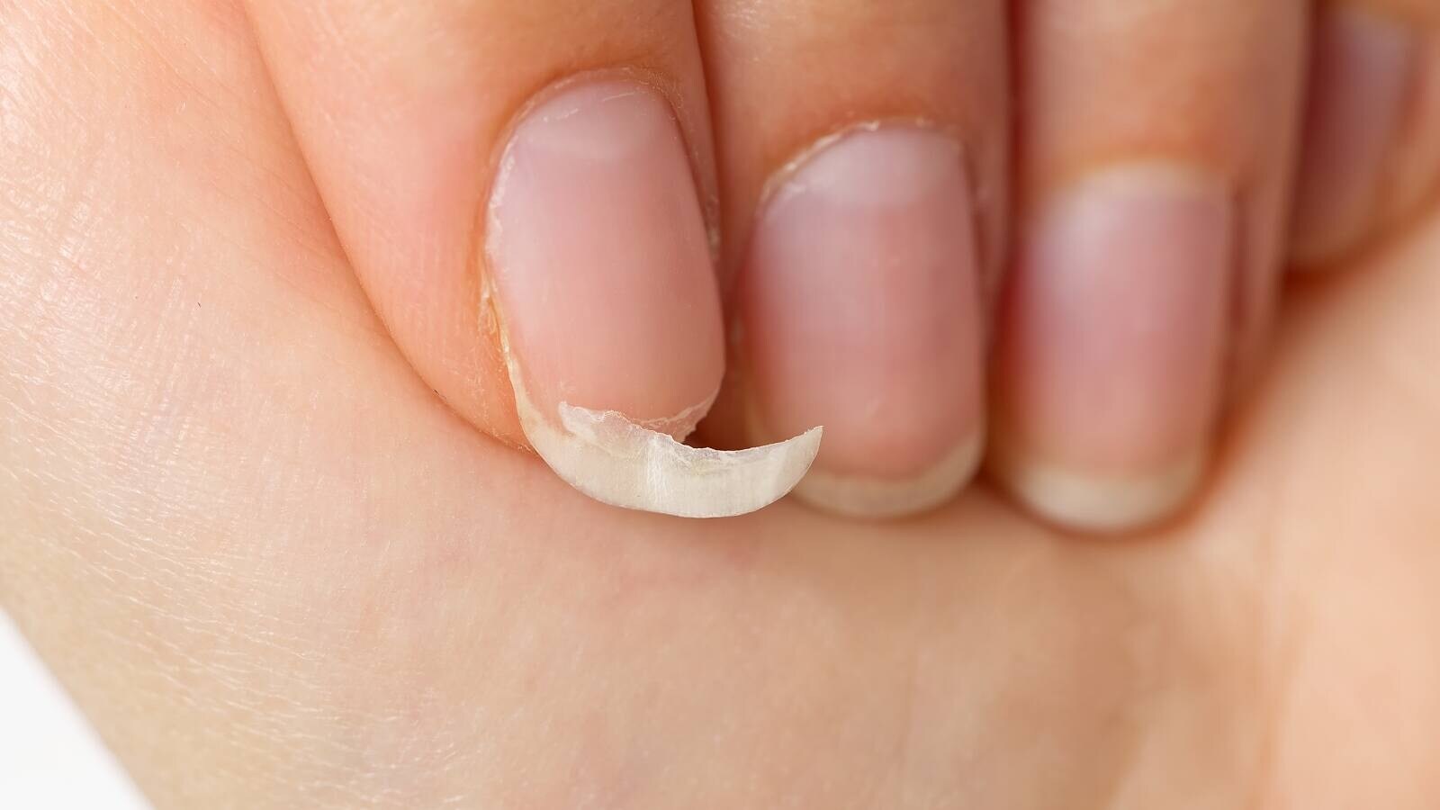 Why Are Your Nails Brittle Understanding Nutrient Deficiencies, Daily Habits, and How to Get Healthy Nails
