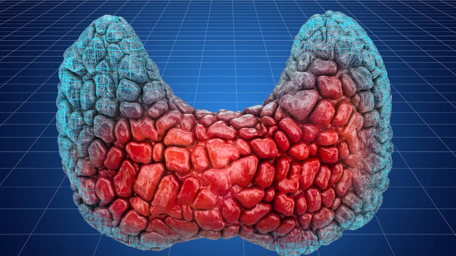 Why Are Thyroid Cases Rising in Women Is Suppressing Emotions the Real Cause What Science Says Why Are Thyroid Cases Rising in Women Is Suppressing Emotions the Real Cause What Science Says