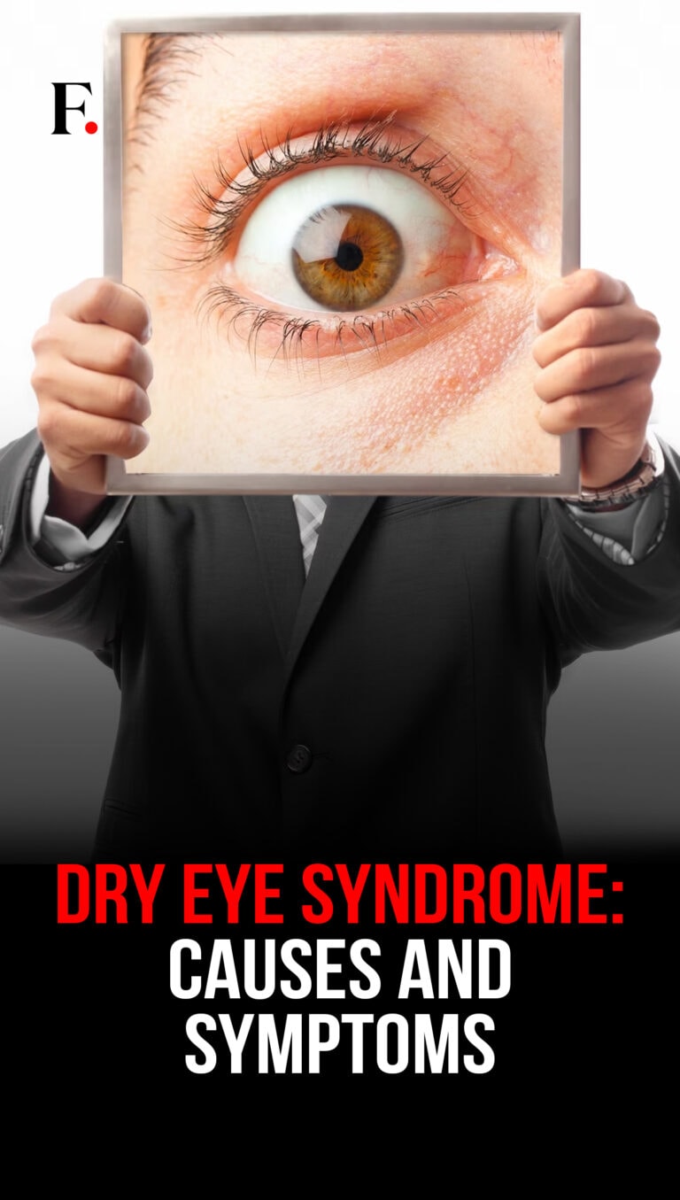 Dry Eye Syndrome Causes And Symptoms Dry Eye Syndrome Causes And Symptoms