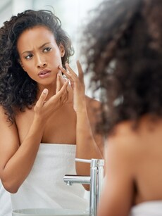 Acne: Home remedies to get rid of acne spots