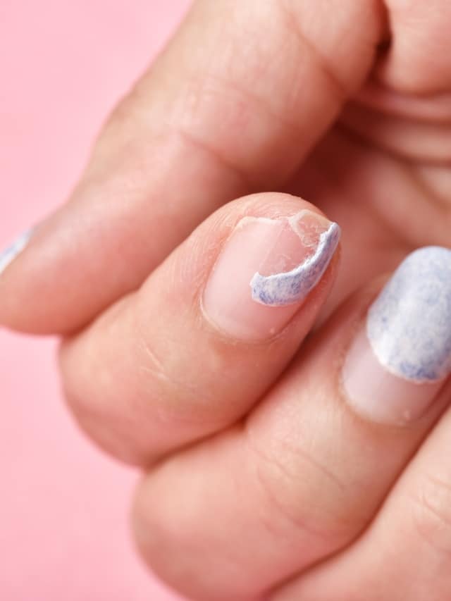 6 Tactics to Deal With Stained Nails