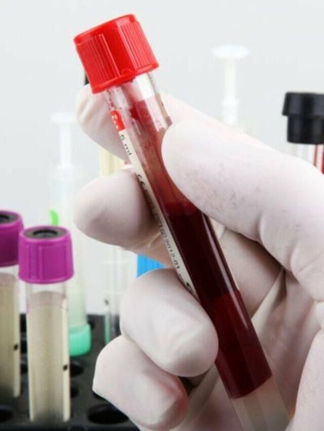 ஃபாஸ்டிங் ப்ளட் சுகர் பரிசோதனை (FBS Test) என்றால் என்ன.?