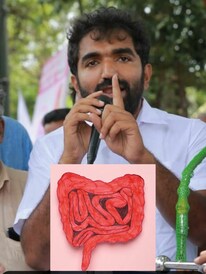 മനുഷ്യന്റെ ചെറുകുടലിന് ഒന്നര കിലോമീറ്റര്‍ നീളമുണ്ടോ?