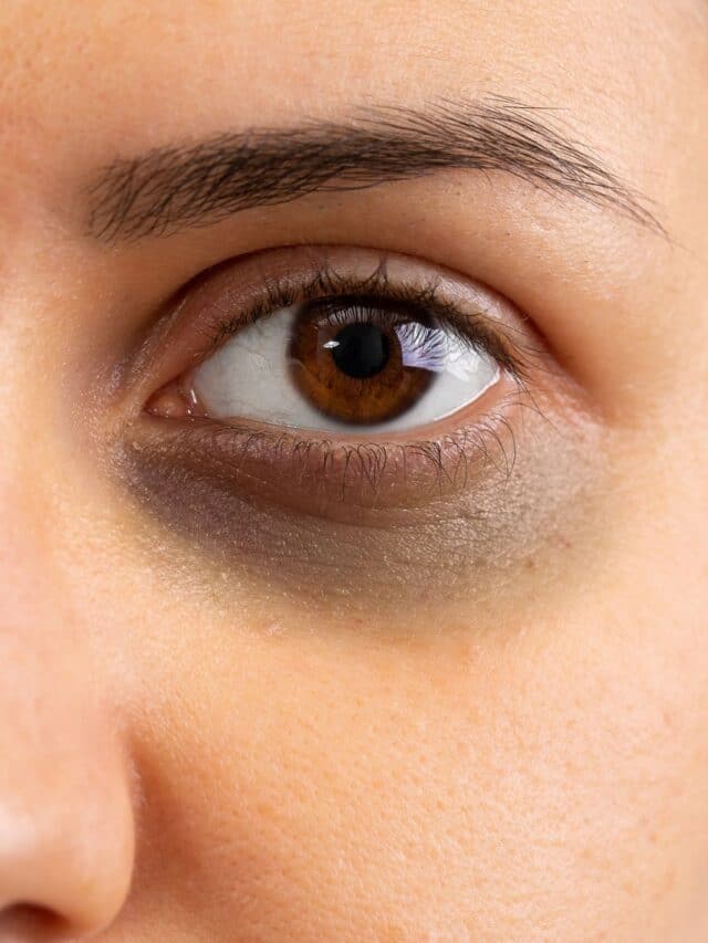6-foods-that-might-reduce-dark-circles