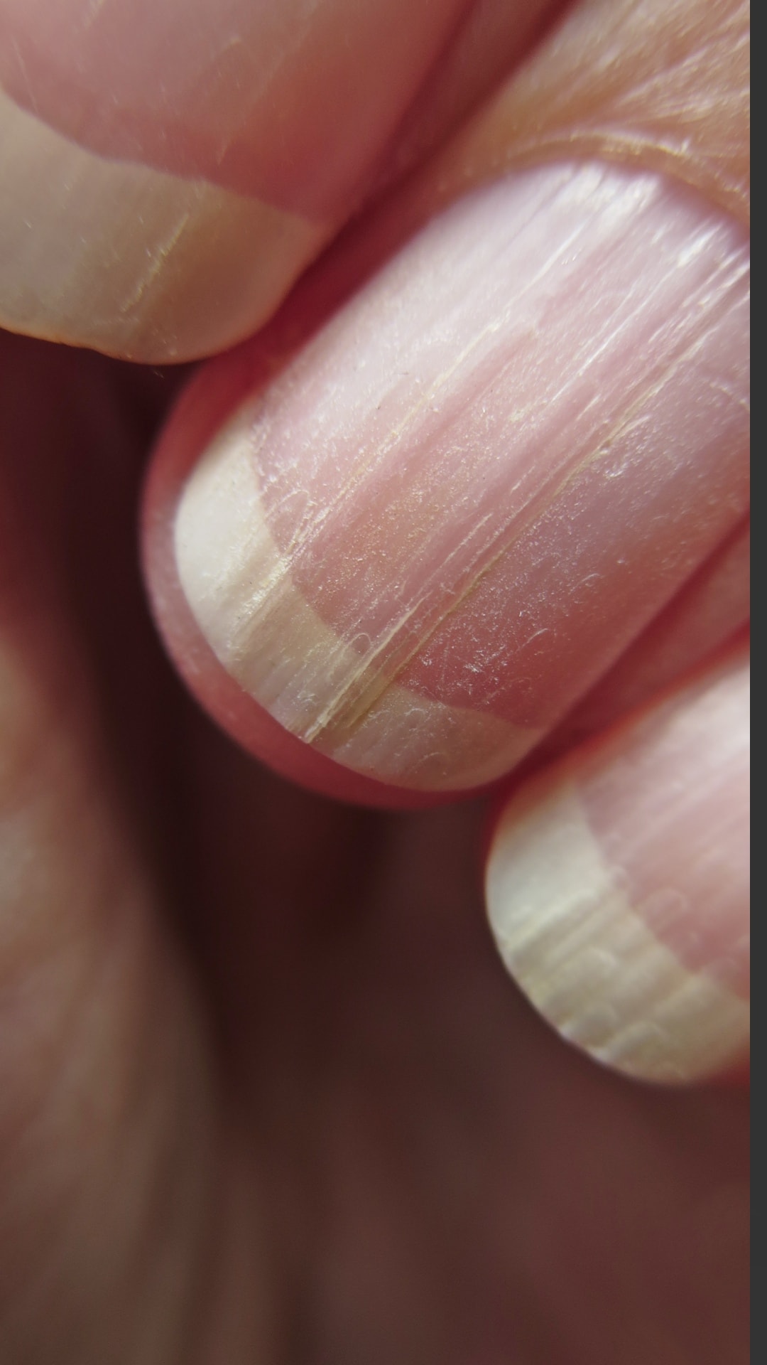 Ridges in Fingernails: Here's What Causes Ridges in Nails - Parade
