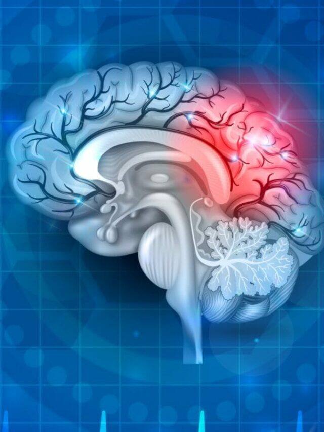 6 Warning Signs Of Mini Strokes