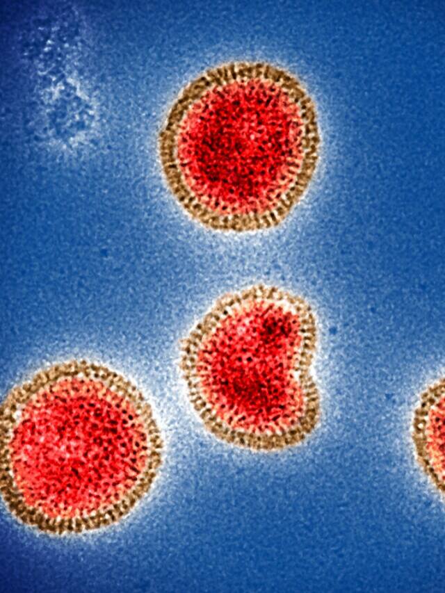 જલ્દી ફેલાઈ શકે છે આ ખતરનાક વાયરસ, ખતમ કરી દેશે મનુષ્યનું અસ્તિત્વ!