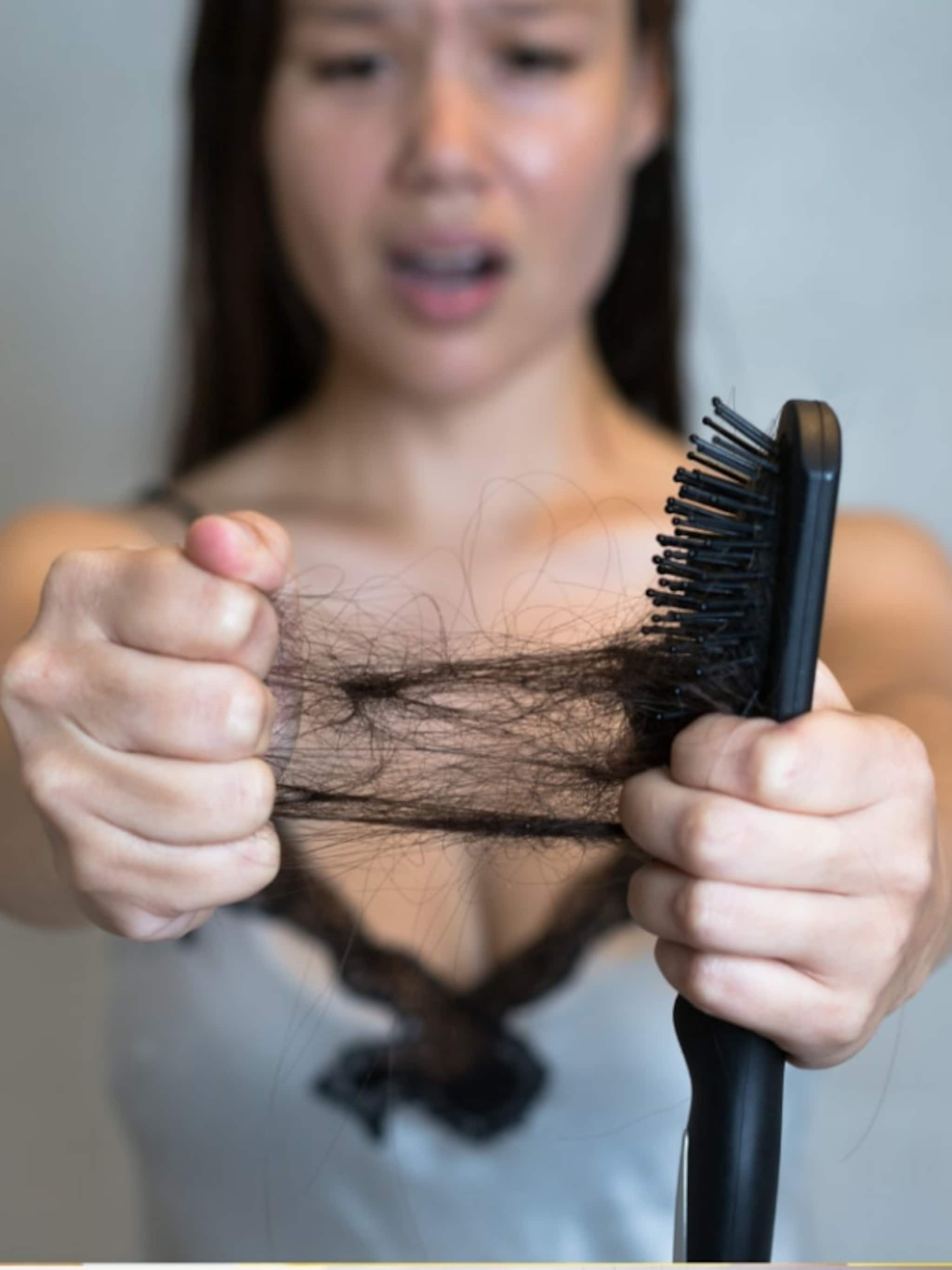 কোন কোন অসুখের ইঙ্গিত দেয় টাক পড়া