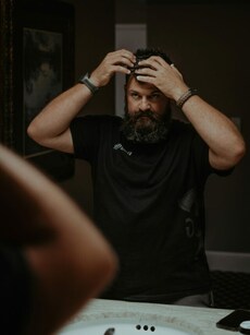 7 ways to deal with dandruff during winter