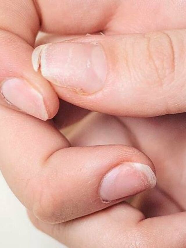 Everything About Nails During Pregnancy: Changes and Care Tips