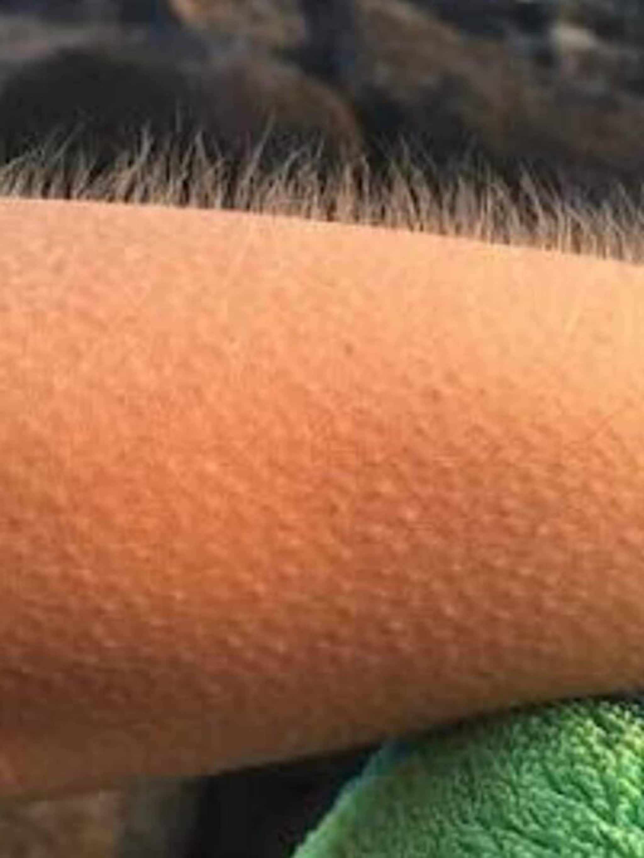 अंगावर काटा का येतो? जाणून घ्या नेमकं कारण