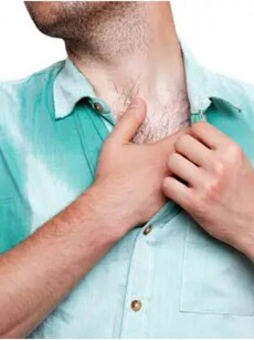 How to manage excessive sweating in summer