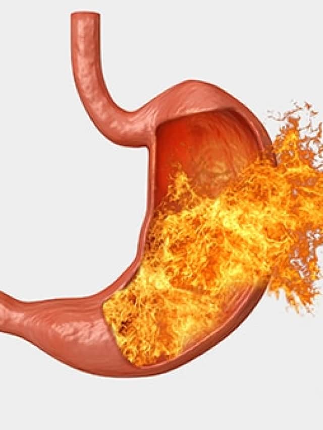 Keep acidity at bay with these 10 natural methods