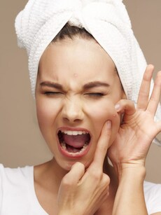 7 home remedies for acne with simple kitchen ingredients