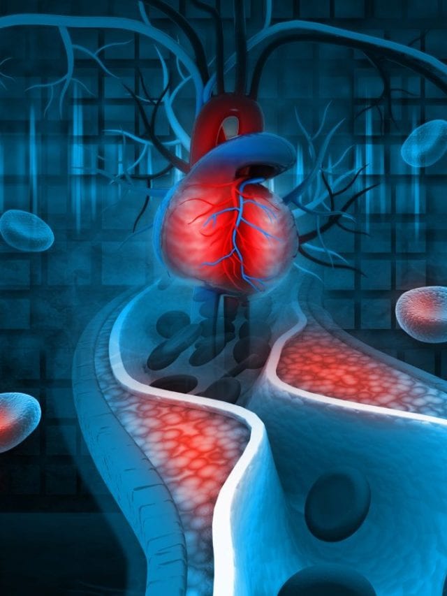 What Foods Are Bad For Kidney Stones what-foods-are-bad-for-kidney-stones