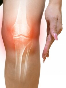 8 health tips to keep bones strong, reduce osteoporosis risk