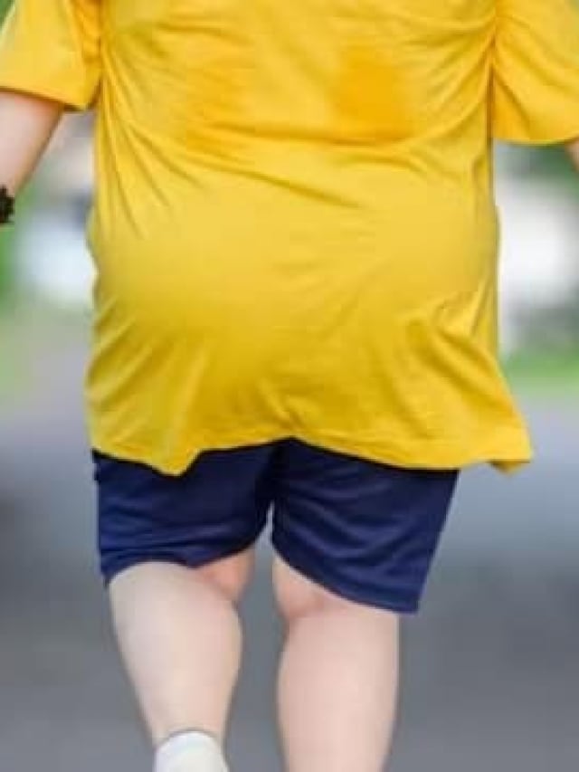 World Obesity Day 2025: Lifestyle Mistakes to Avoid