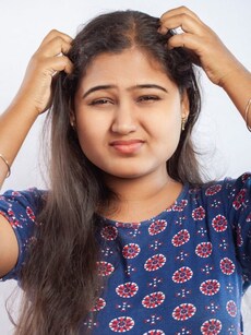 10 causes of dandruff: Your scalp may be hungry, not dirty