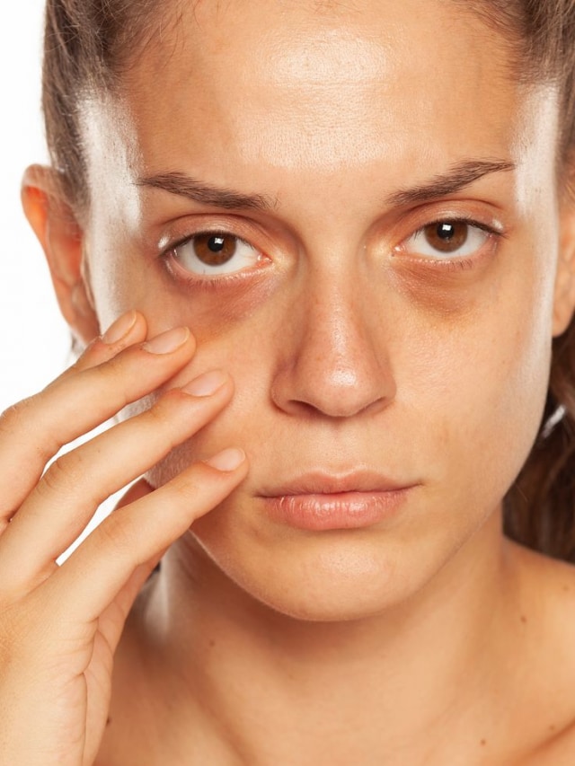 Not Just Tired: 10 lifestyle causes of facial puffiness