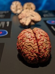 5 unhealthy habits that are slowly, secretly damaging your brain