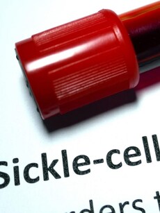 World Sickle Cell Day: 9 things to know about this blood disorder