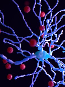 Is It Just Confusion or Delirium? Here’s What You Should Know