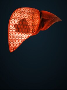 Liver Cirrhosis: Causes, symptoms, and how to manage this condition