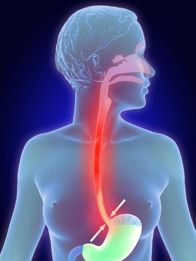 Heartburn Havoc: 10 Common Mistakes Triggering Acid Reflux (and How to Fix Them!)