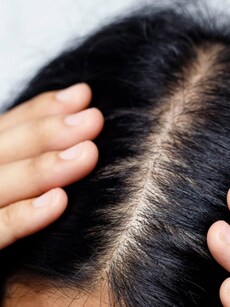 5 best hair oils to stop bald spots, thinning roots and itchy scalps