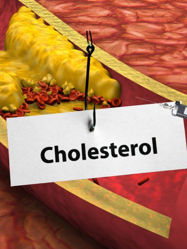 कोलेस्ट्रॉल कंट्रोल करने के लिए क्या खाएं?
