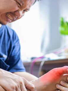 Gout Pain Relief Tips: 10 Simple Ways to  Stop Flare-Ups