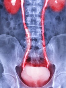 10 signs of bladder cancer: Fatigue, weight loss and more