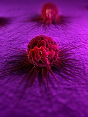 ক্যানসারের কোন-কোন প্রাথমিক উপসর্গ আমরা এড়িয়ে যাই?