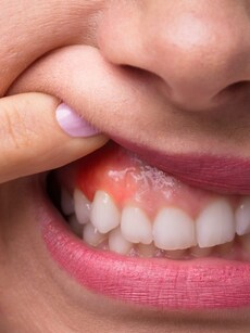 10 healthy habits to steer clear of  gum disease