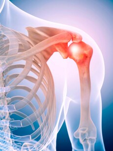 Frozen shoulder: Causes, symptoms of this painful condition