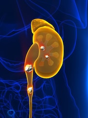 কম প্রোটিন খাওয়ার মতো সহজ কয়েকটা অভ্যাসেই বশে ক্রিয়েটিনিন