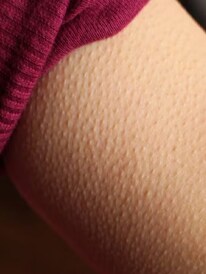 গায়ে কাঁটা দেয় কেন জানেন? অবাক হবেন উত্তরে!