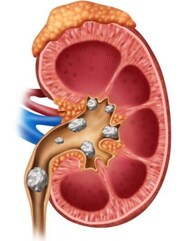 কোন ৭টা কারণ কিডনি নষ্টের পিছনে দায়ী?