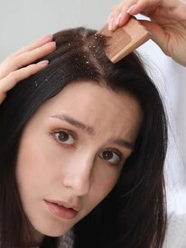 খুশকিতে ভরে গিয়েছে মাথা! কোন ভিটামিনের অভাবে হচ্ছে জানেন?