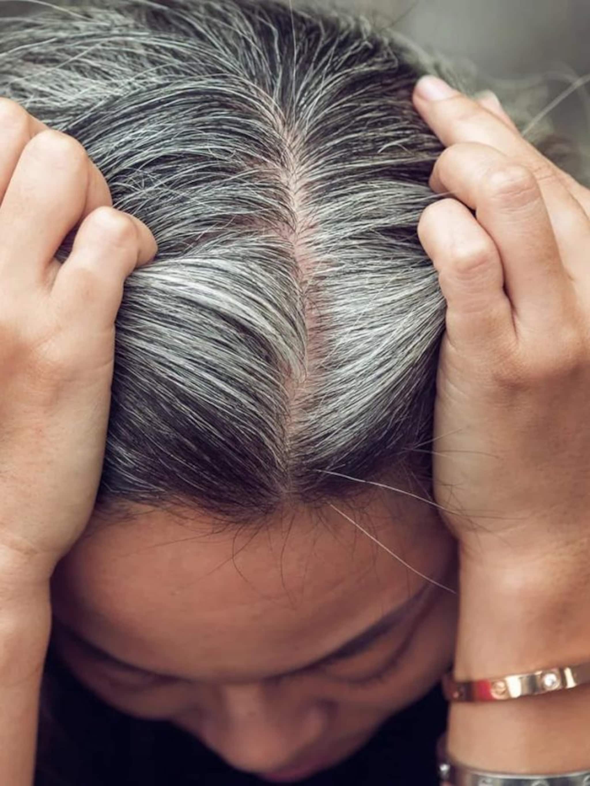 ৩০–৪০ বয়সেই সাদা চুল? Young থাকার উপায় কী!